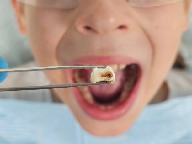 Best Same-Day Dentist Appointment  in East Richmond Heights, CA
