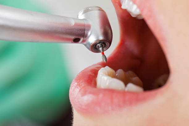 Best Walk-In Dentist Near Me  in East Richmond Heights, CA